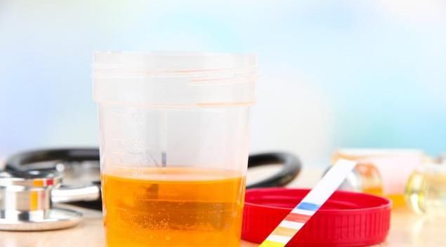  免疫抑制剂|降蛋白延缓肾功能，预防尿毒症，有3种方法可以选择