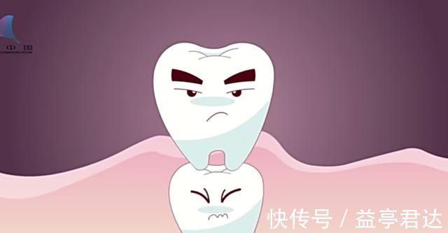 双排牙|6-12岁孩子换牙期,父母困惑可不少:双排牙、锯齿状、缝隙大等