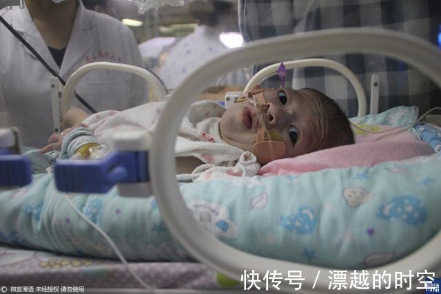 邱娟|泪目!女子求助无门欲拔掉娃的氧气时,孩子突然伸手给她擦眼泪