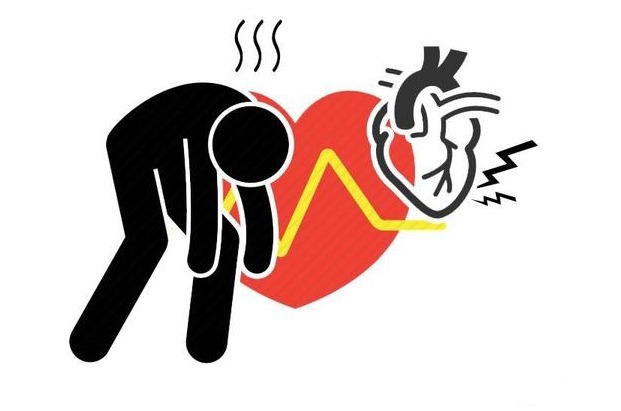 血流动力学|心律失常不是小事,久托不治,酿成大病!身体有8个异常,尽快看