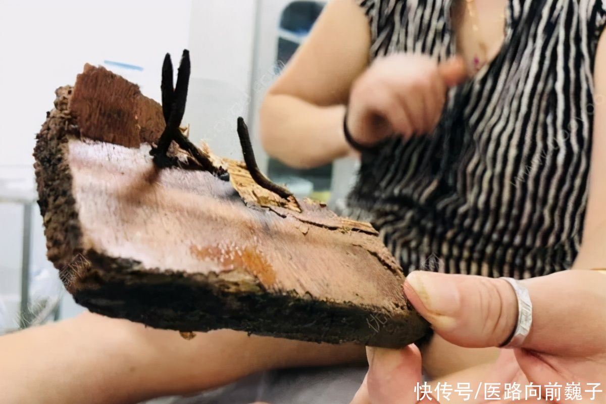 潜伏期|每年100万人死于此病！医生：身上的伤口别这样处理