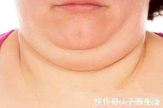 肌肤|无论男女,脖子上出现这种“问题”,别大意!赶紧采取措施