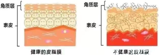 痘痘|被皮肤科医生点名拉入“黑名单”的洗面奶，千万不要用，小心皮肤越来越差