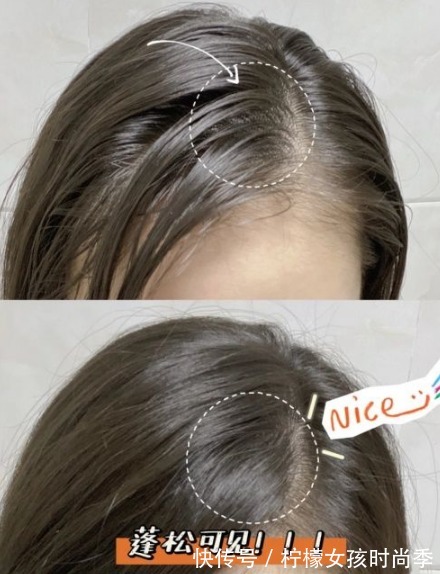 油头|孕期头皮油头发干?洗头发后注意这三点,油头也可以变蓬松