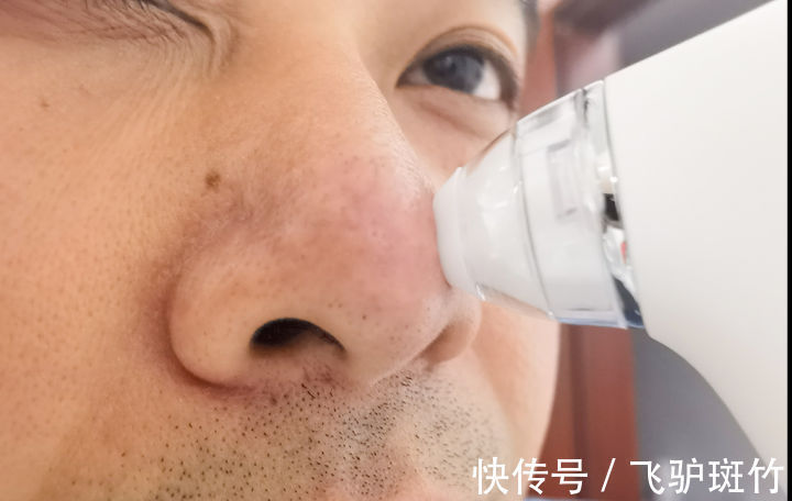 毛孔|去油从清理毛孔脏东西开始——DOCO小气泡黑头仪体验