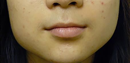 你周围大脸的女生多吗？拥有一张大脸是种怎样的感受？