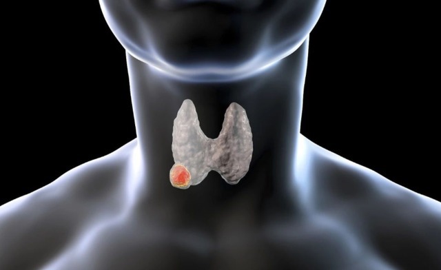 甲状腺结节患者|甲状腺结节不能吃羊肉真正不能吃的食物，已列成清单，建议收藏