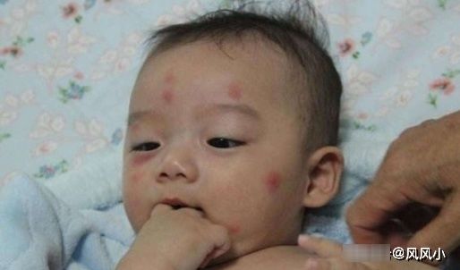 皮肤|婴儿宝宝皮肤嫩，这些东西最好不要让他们接触到，家长们多留个心
