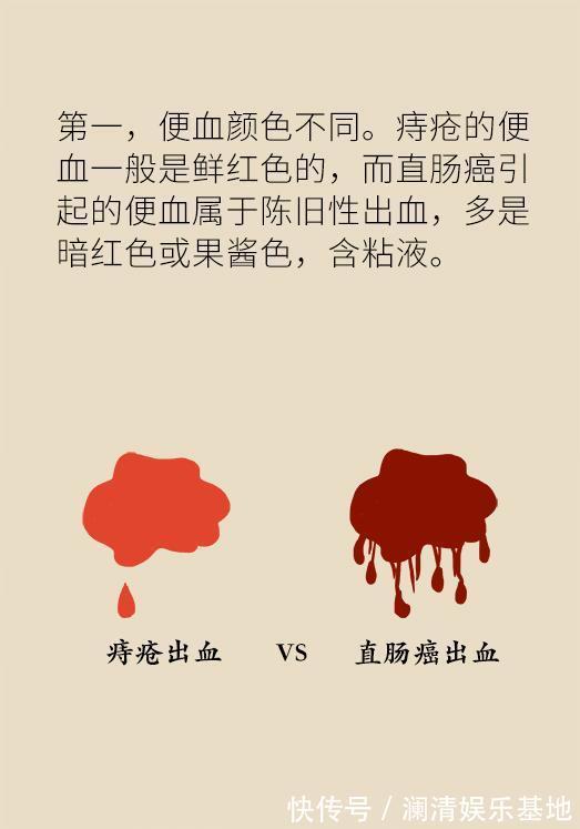 筛查|50岁以后高发的癌症,这5类人提前10年筛查,就能避免太多悲剧