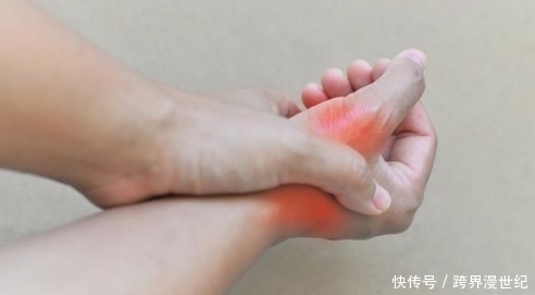 痛风患者如何注意饮食?5个小建议,助你有效控尿酸,防痛风