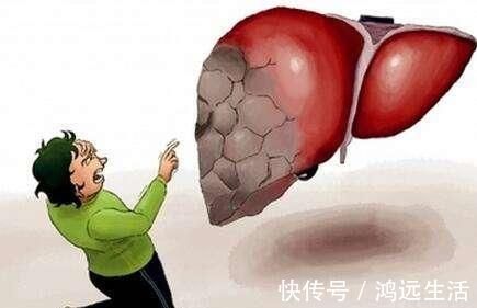 食物|肝脏“喜欢”的几种食物,每天换着吃,排毒养肝,肝脏越来越健康