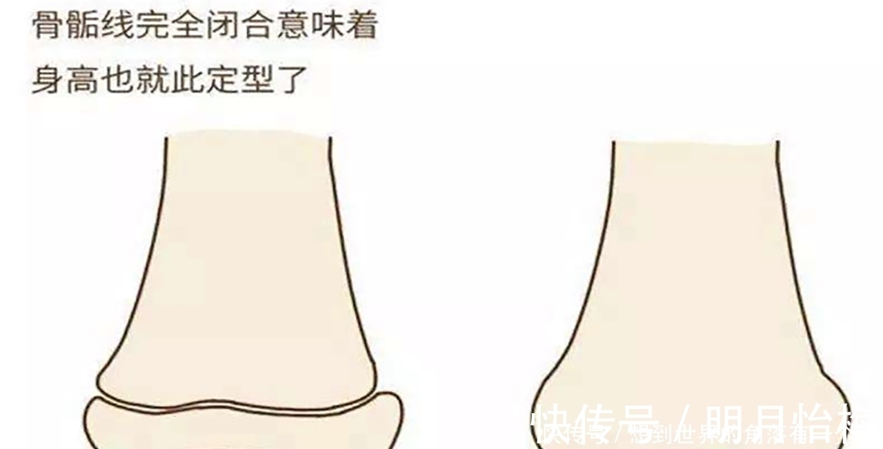 儿童|孩子长不高,全怪妈妈矮孩子骨骼发育的3个注意事项