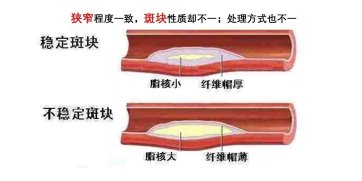 服用|曾运雄博士指出：从“心”做起，心血管疾病可控可防