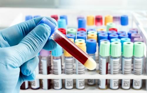 癌症|为什么动不动就要做血常规检查？做一次血常规，能查出什么？