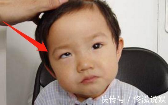 黑眼珠|6岁娃经常玩这“玩具”,黑眼珠慢慢“消失”,医生很难恢复