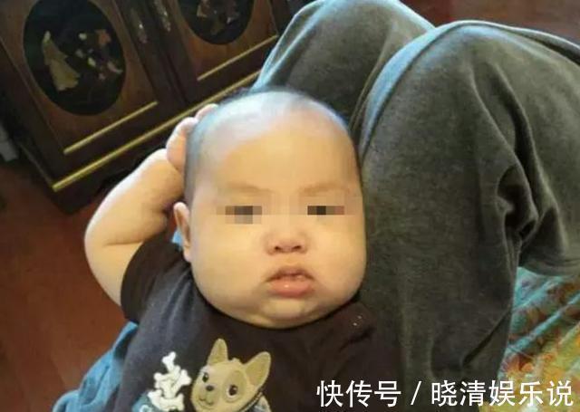 医生|2岁儿子频繁摸头,母亲觉得不对劲带去检查,医生幸亏来得及时