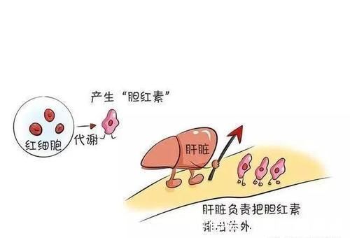 宝妈|宝宝有点黄，到底要不要紧？新手父母不用慌