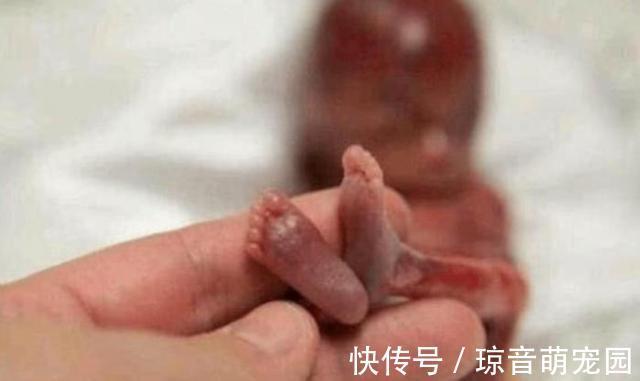 体重|在娘胎里只呆了22周的宝宝,出生时体重仅为245克,世界最小婴儿