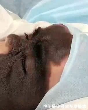 胎记|7个月婴儿脸上因巨大黑色胎记爆红！像带着“蝙蝠侠”面具！