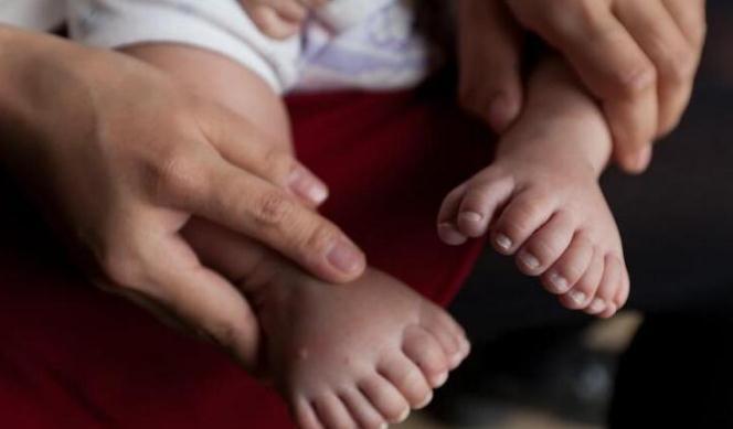 多指症|3个月大的男婴为何长出31根指头?得知原因后母亲崩溃痛哭