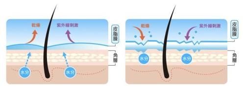 皮肤又油又干还爱起屑是怎么回事？