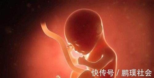 脐带|6个月脐带扭转导致胎停,是什么原因造成?以后怀孕要怎么注意?
