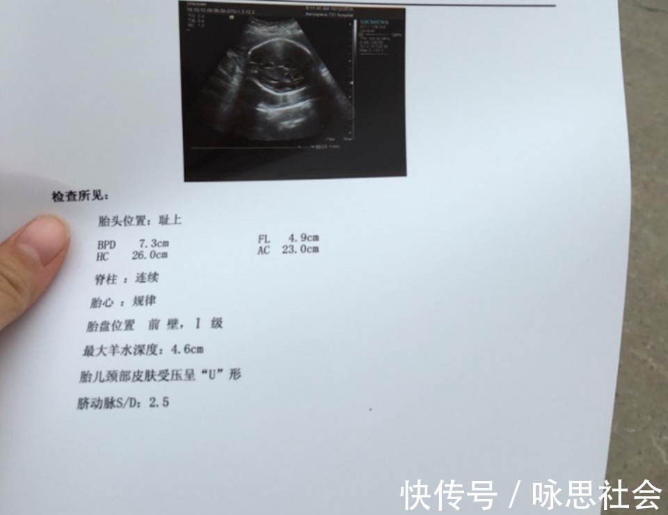 孕妈|孕28周后产检时，孕妈记得问3个问题，更利于日后的分娩