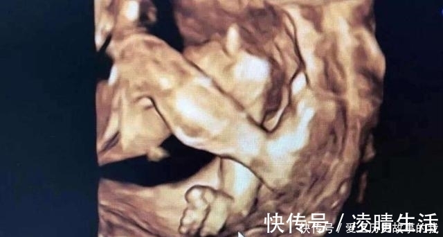 宝宝|四维彩超,孕妈们最期待的产检,除了看宝宝的照片还需要看什么?