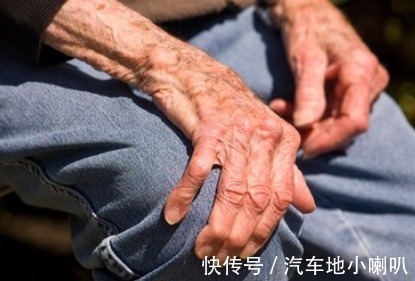 膝盖|膝盖经常怕冷疼痛,会是关节炎吗?赶紧了解一下