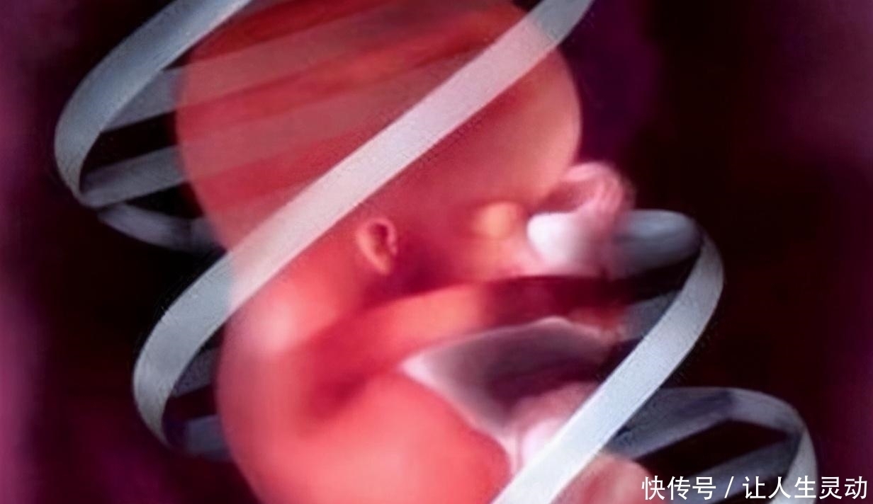 信号|胎儿没出生就脐带断裂,医生也无能为力,孕妈抓住宝宝求救信号