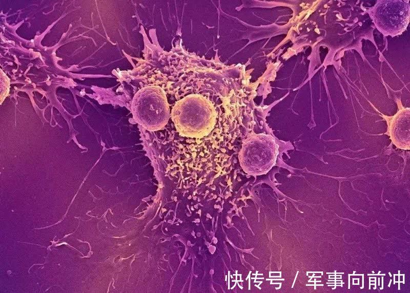 手术|癌症手术后,如何防止复发转移?中医说的这些,都是经验