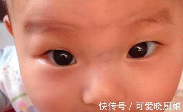 磨娘筋|老人言“鼻梁青,磨娘精”,鼻梁上有青筋的宝宝真的难带吗?