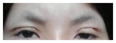 你真的知道吗?【医美误区】