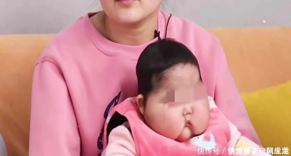 汗毛|“大头娃娃”事件卷土重来：这款婴儿霜激素超标，请家长赶快自查