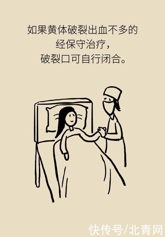 腹痛|这种腹痛常被误认宫外孕，背后诱因要牢记