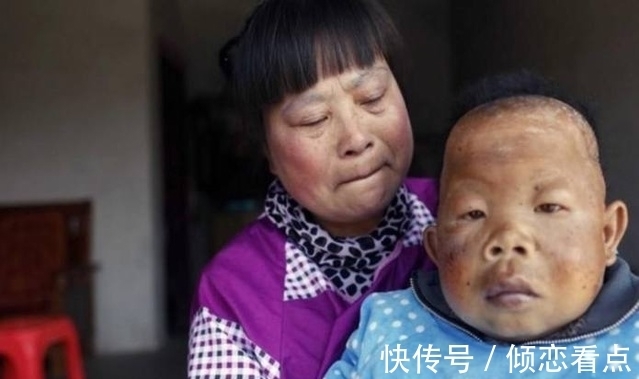 智力障碍|身体像3岁大婴儿却已活了30年,从未叫过一声妈,真相让人落泪