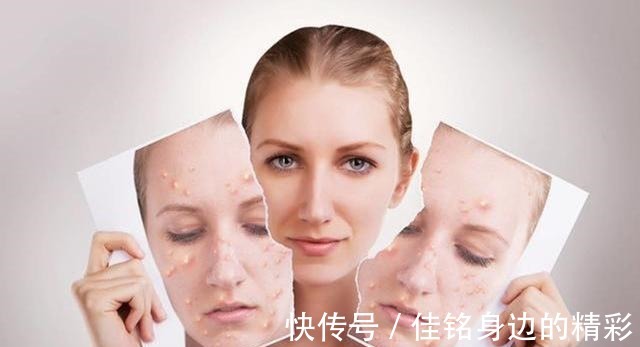 皮肤 皮肤老爱出油这几个护肤知识要知道,让你摆脱“大油田”!