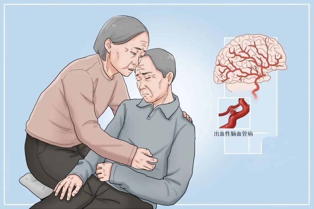 五十二病方|国医大师任继学:从伏邪论治出血性中风经验