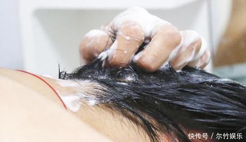 头皮上抠出很多“白泥”,只是头皮屑,还是螨虫在头上扎窝了