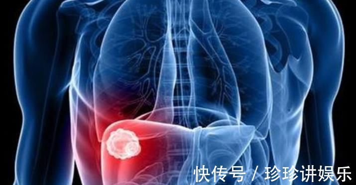 好东西|泡枸杞时加此物，肝毒没了，远离肝硬化、肝癌，肝会跪谢你的做法