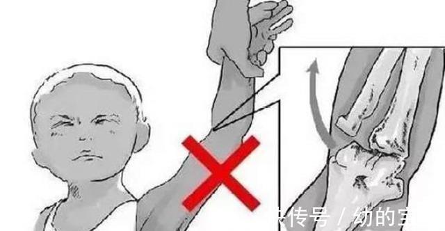 动作|因为父母1个小失误,1岁宝宝学走路致脑损伤!别大意了