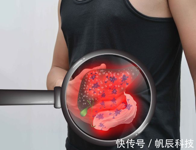 病毒性肝炎|身体这6个标志，或是肝硬化的信号，有3个以上，提示肝病在恶化