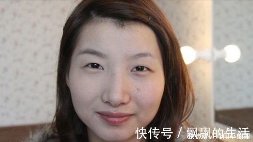 手术|手术割了双眼皮的人,老了之后有什么影响?看完真要留意了