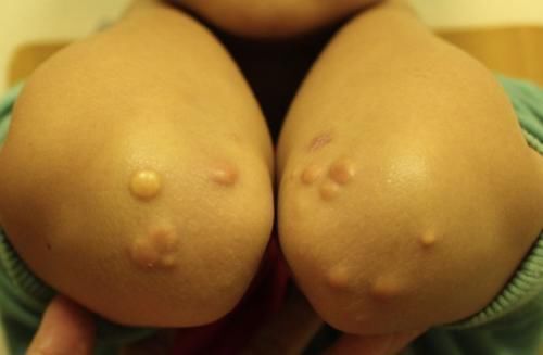 血液循环|“胆固醇大户”被找到,并不是猪肉,建议少吃,为了健康不妨了解