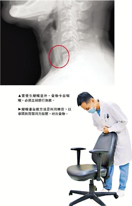 抢救|专心进食/鲠喉意外 抢救关键5分钟