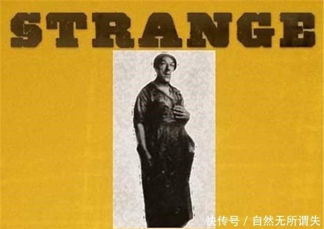 母亲|“怪物”玛丽:为了孩子参加选丑比赛,用自己的外貌换取金钱