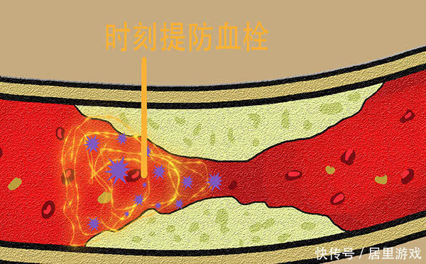 每天喝点小酒，对血管有好处吗？每天喝多少酒，有利于身体健康？