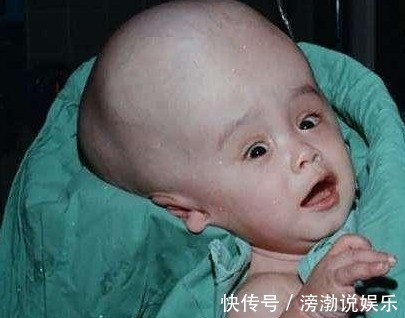 生活环境|怀孕20周,四维彩超却发现胎儿畸形,闻到孕妇身上的味道明白了