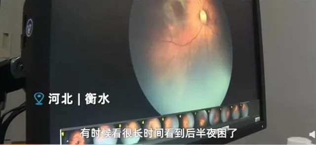 睡前玩手机？小心！90后小伙躺着玩手机差点看不见了！|震惊 | 小伙