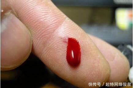 不痒|肝癌不痒不痛, 发现了已是晚期, 身体这5个信号要注意